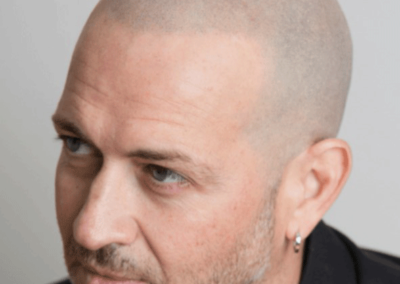 Bald head of man