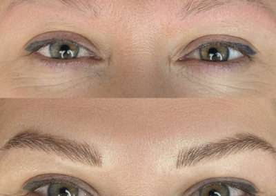 Eye brow before after