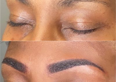 Closed eyes before after